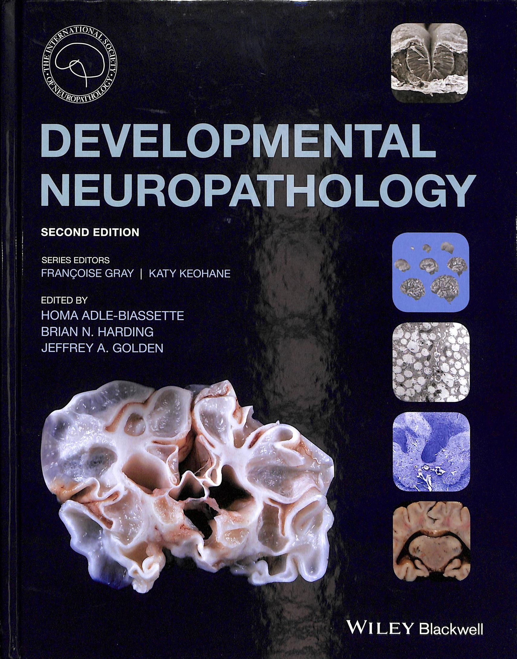 Developmental Neuropathology 9781119013082 (Paperback)