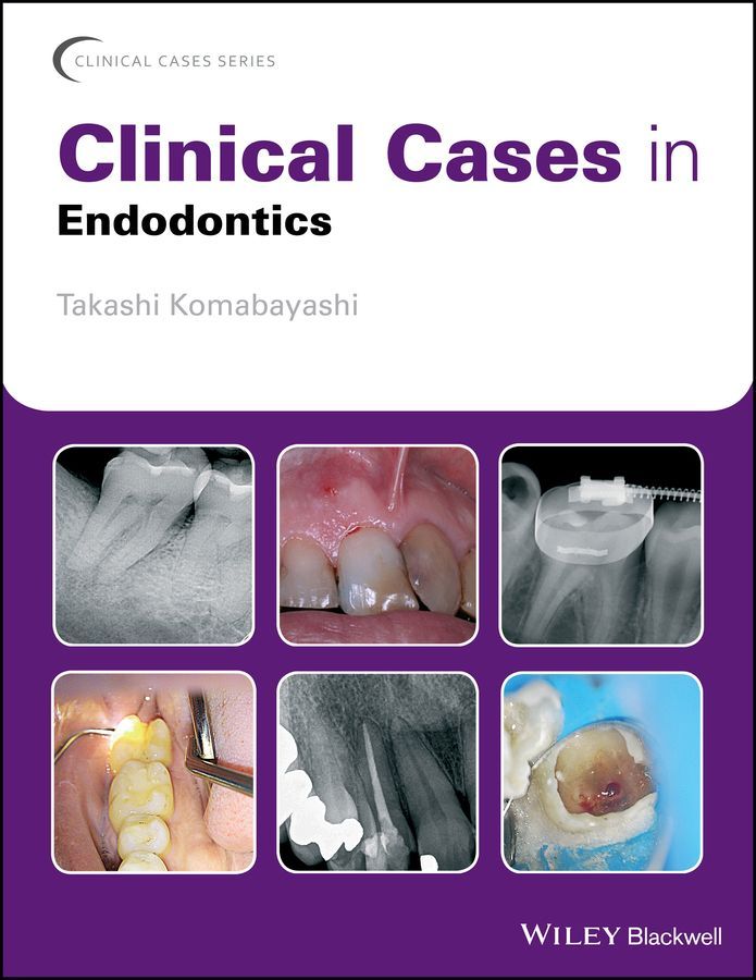 Clinical Cases in Endodontics By Takashi Komabayashi (editor)