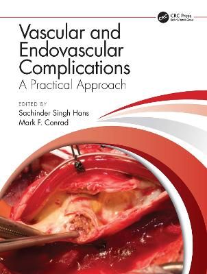Vascular and Endovascular Complications 9781138352933 (Hardback)