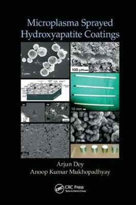 Microplasma Sprayed Hydroxyapatite Coatings 9781138748866 (Paperback)