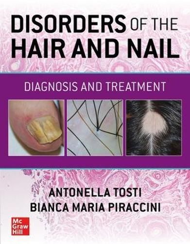 Disorders of the Hair and Nail 9781260462470 (Paperback)