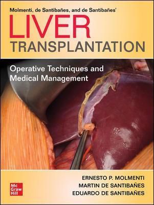 Liver Transplantation 9781260462517 (Paperback)