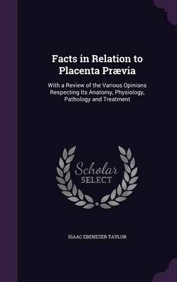 Facts in Relation to Placenta Prævia By Taylor 9781357695736