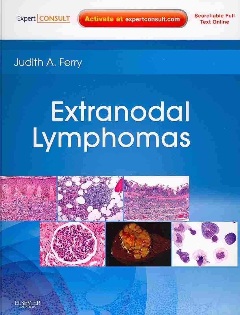 Extranodal Lymphomas By Judith A. Ferry 9781416045793 (Hardback)