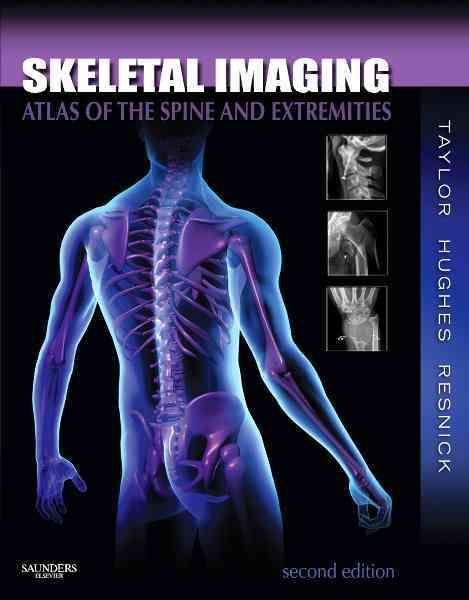 Skeletal Imaging By John A. M. Taylor, Donald Resnick 9781416056232