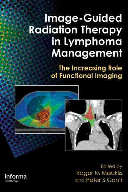 Image-Guided Radiation Therapy in Lymphoma Management 9781420058741