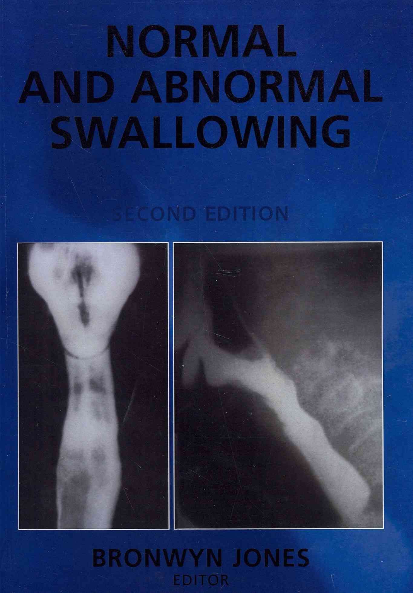 Normal and Abnormal Swallowing By Bronwyn Jones 9781441929044