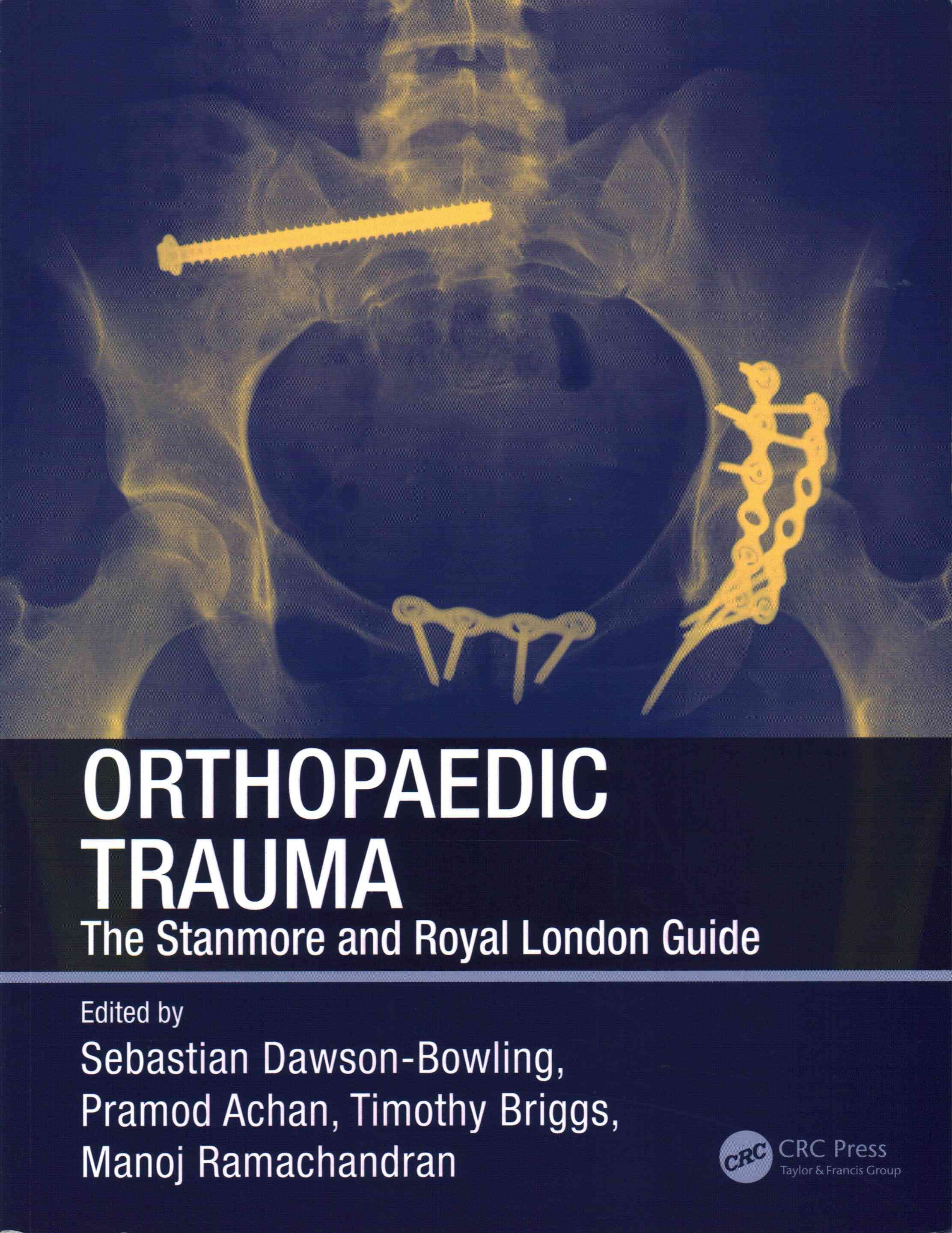 Orthopaedic Trauma: The Stanmore and Royal London Guide 9781444148824