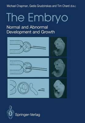 The Embryo 9781447118046 (Paperback)