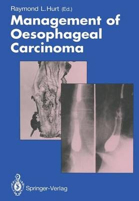 Management of Oesophageal Carcinoma By Raymond L. Hurt (editor)