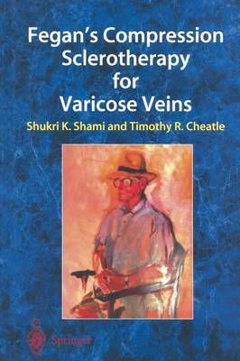 Fegan's Compression Sclerotherapy for Varicose Veins 9781447134756