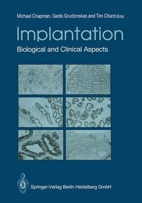 Implantation 9781447135319 (Paperback)