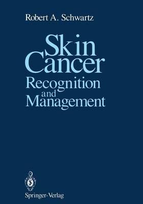 Skin Cancer By Robert A. Schwartz 9781461283522 (Paperback)