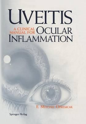Uveitis By Opremcak, E. Mitchel 9781461286851 (Paperback)