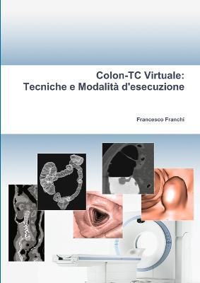 Colon-TC Virtuale By Francesco Franchi 9781471680069 (Paperback)
