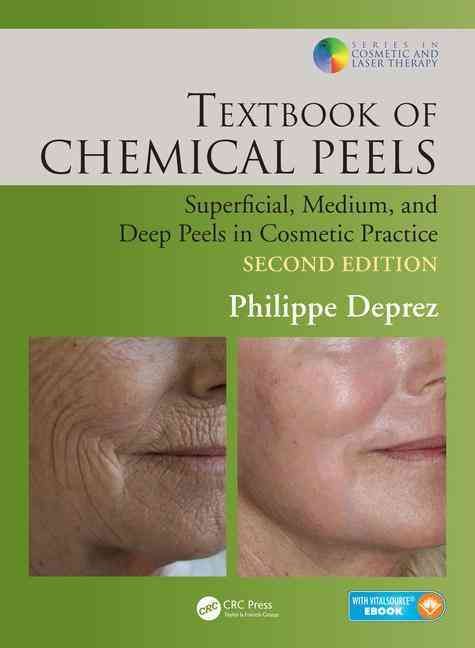 Textbook of Chemical Peels By Philippe Deprez 9781482223934 (Hardback)