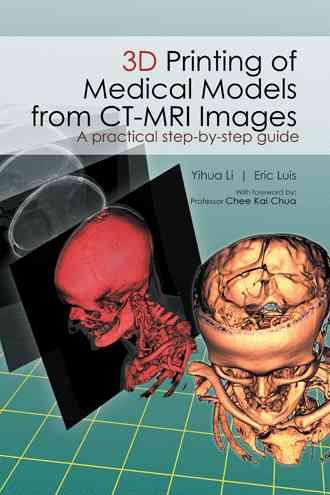 3D Printing of Medical Models from CT-MRI Images By Li Yihua