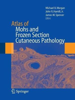 Atlas of Mohs and Frozen Section Cutaneous Pathology 9781493950683