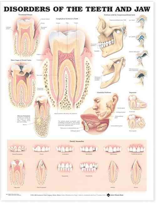 Disorders of the Teeth and Jaw Anatomical Chart 9781587792496