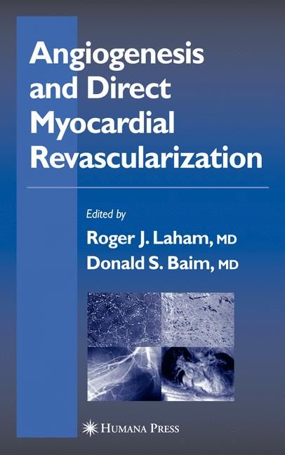 Angiogenesis and Direct Myocardial Revascularization 9781588291530