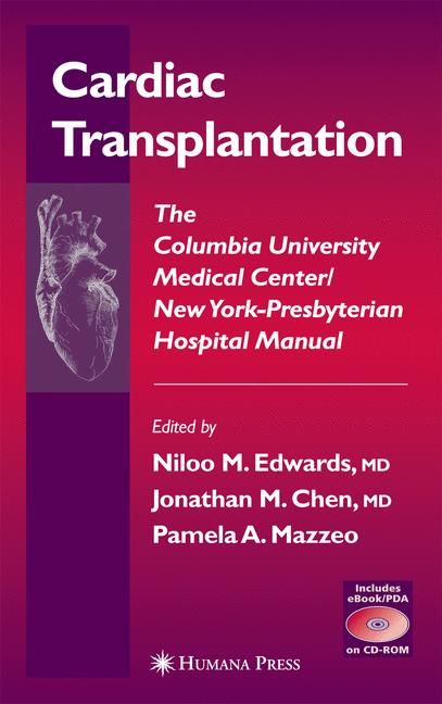 Cardiac Transplantation 9781588291813 (Hardback)