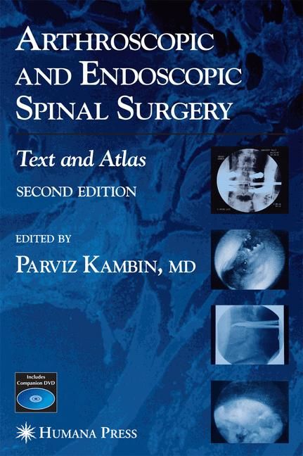 Arthroscopic and Endoscopic Spinal Surgery By Parviz Kambin (Hardback)
