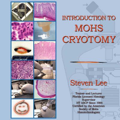 Introduction to MOHS Cryotomy 9781595408648 (Paperback)