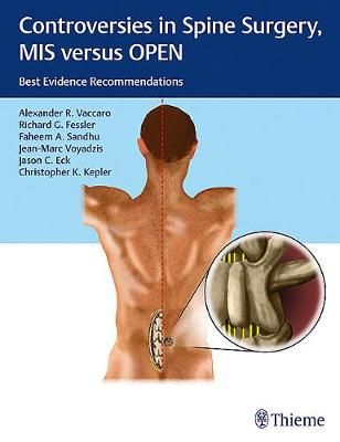 Controversies in Spine Surgery, MIS Versus Open 9781604068818