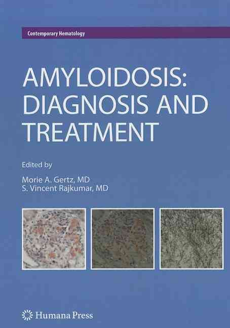 Amyloidosis By Morie A. Gertz, S. Vincent Rajkumar 9781607616306