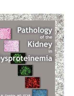 Pathology of the Kidney in Dysproteinemia By Charles N Gamble