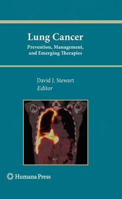 Lung Cancer By David J. Stewart (editor) 9781617796845 (Paperback)