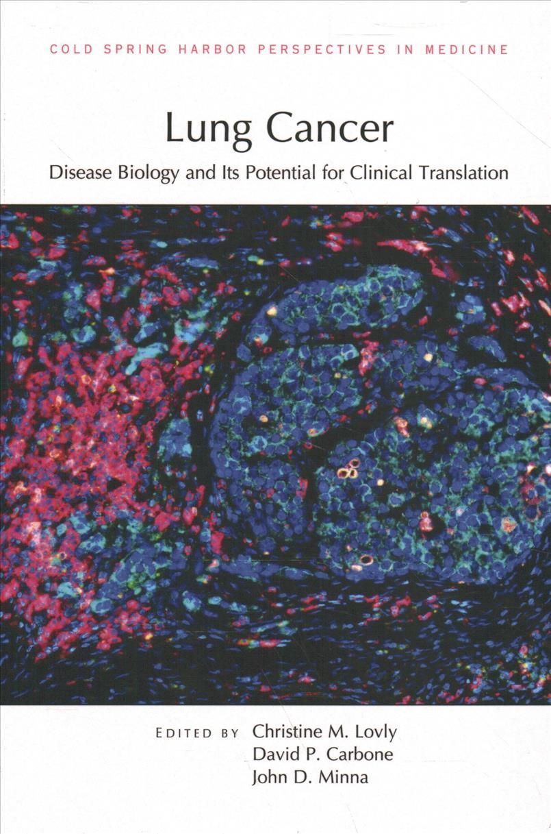 Lung Cancer 9781621823735 (Hardback)