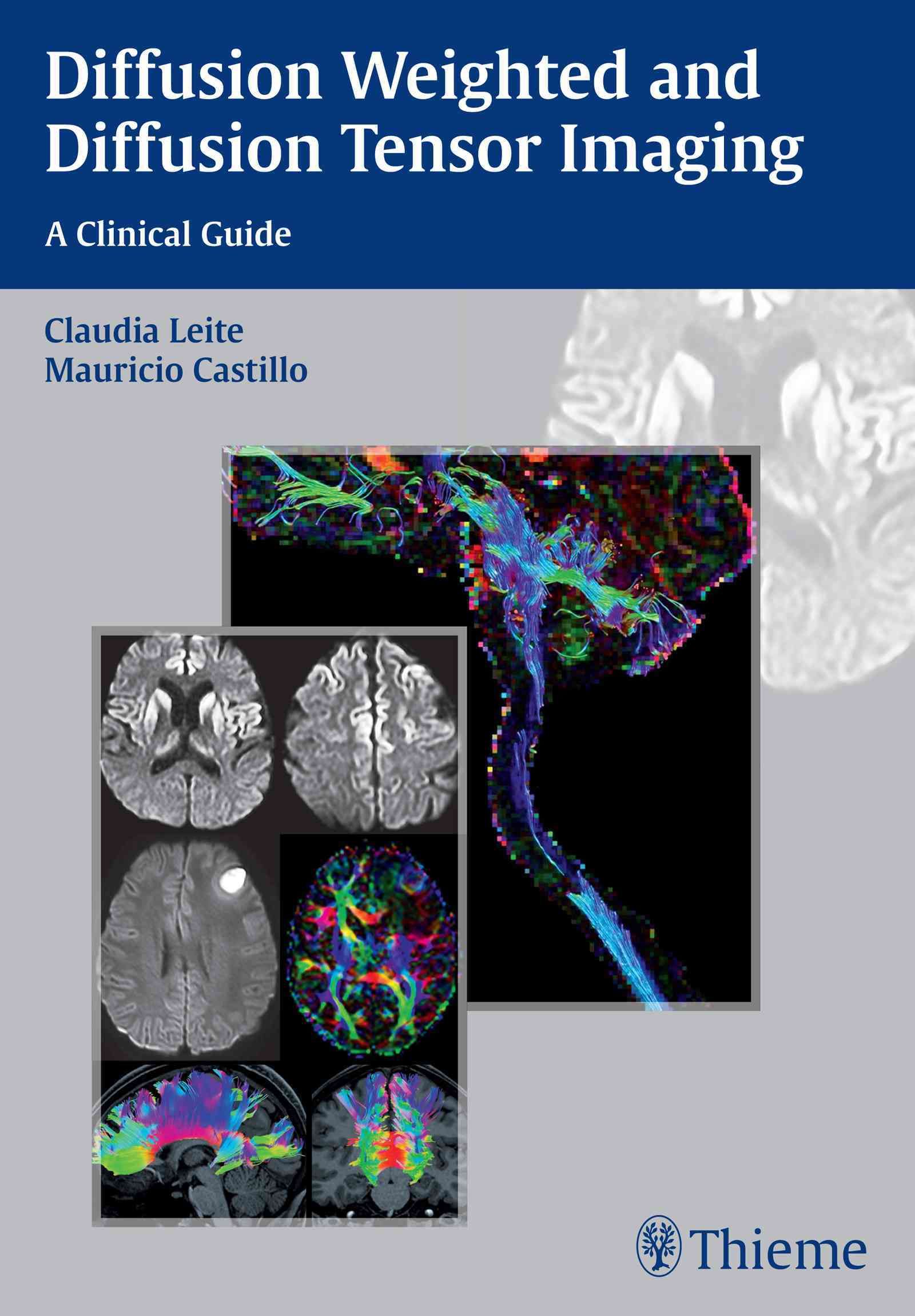Diffusion Weighted and Diffusion Tensor Imaging 9781626230217