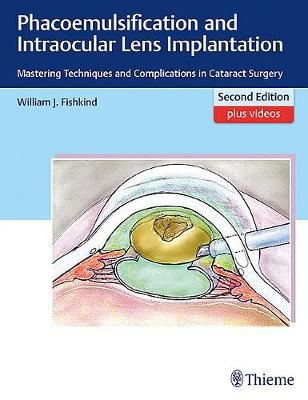 Phacoemulsification and Intraocular Lens Implantation 9781626231290