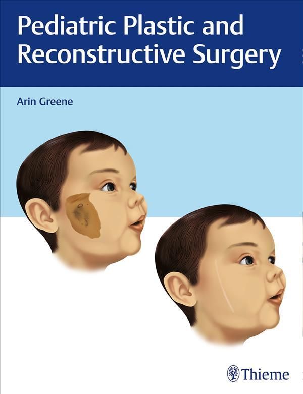 Pediatric Plastic and Reconstructive Surgery 9781626232624 (Paperback)