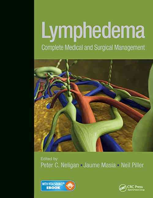 Lymphedema ? Complete Medical and Surgical Management By Peter Neligan