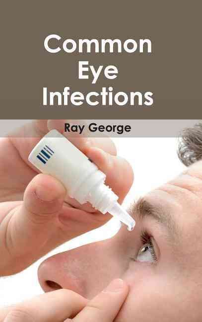 Common Eye Infections By Ray George 9781632410948 (Hardback)