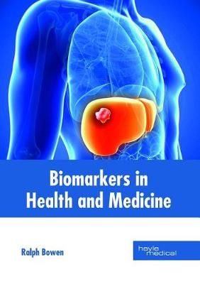 Biomarkers in Health and Medicine By Ralph Bowen (editor) (Hardback)