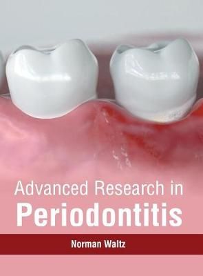Advanced Research in Periodontitis By Waltz 9781632415684 (Hardback)