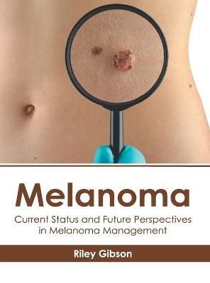 Melanoma: Current Status and Future Perspectives in Melanoma Management