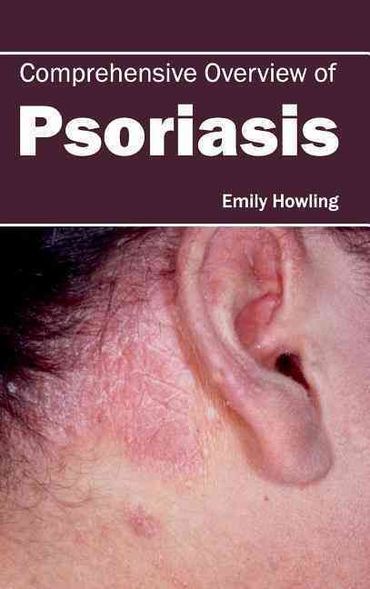 Comprehensive Overview of Psoriasis By Emily Howling 9781632420893