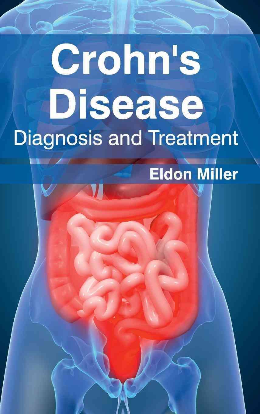Crohn's Disease: Diagnosis and Treatment By Eldon Miller 9781632420978