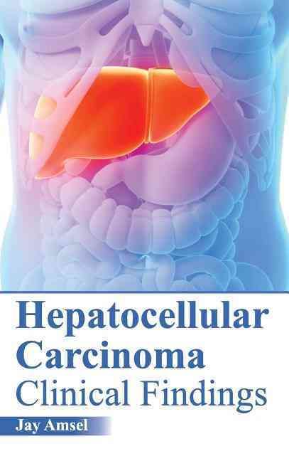 Hepatocellular Carcinoma: Clinical Findings By Jay Amsel 9781632422286