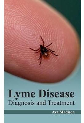 Lyme Disease: Diagnosis and Treatment By Ava Madison 9781632422620