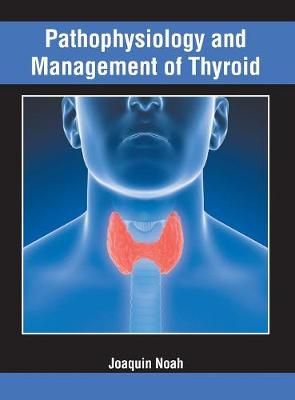 Pathophysiology and Management of Thyroid By Noah 9781632426512