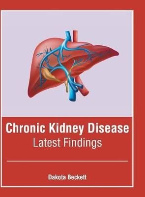 Chronic Kidney Disease: Latest Findings By Beckett 9781632427069