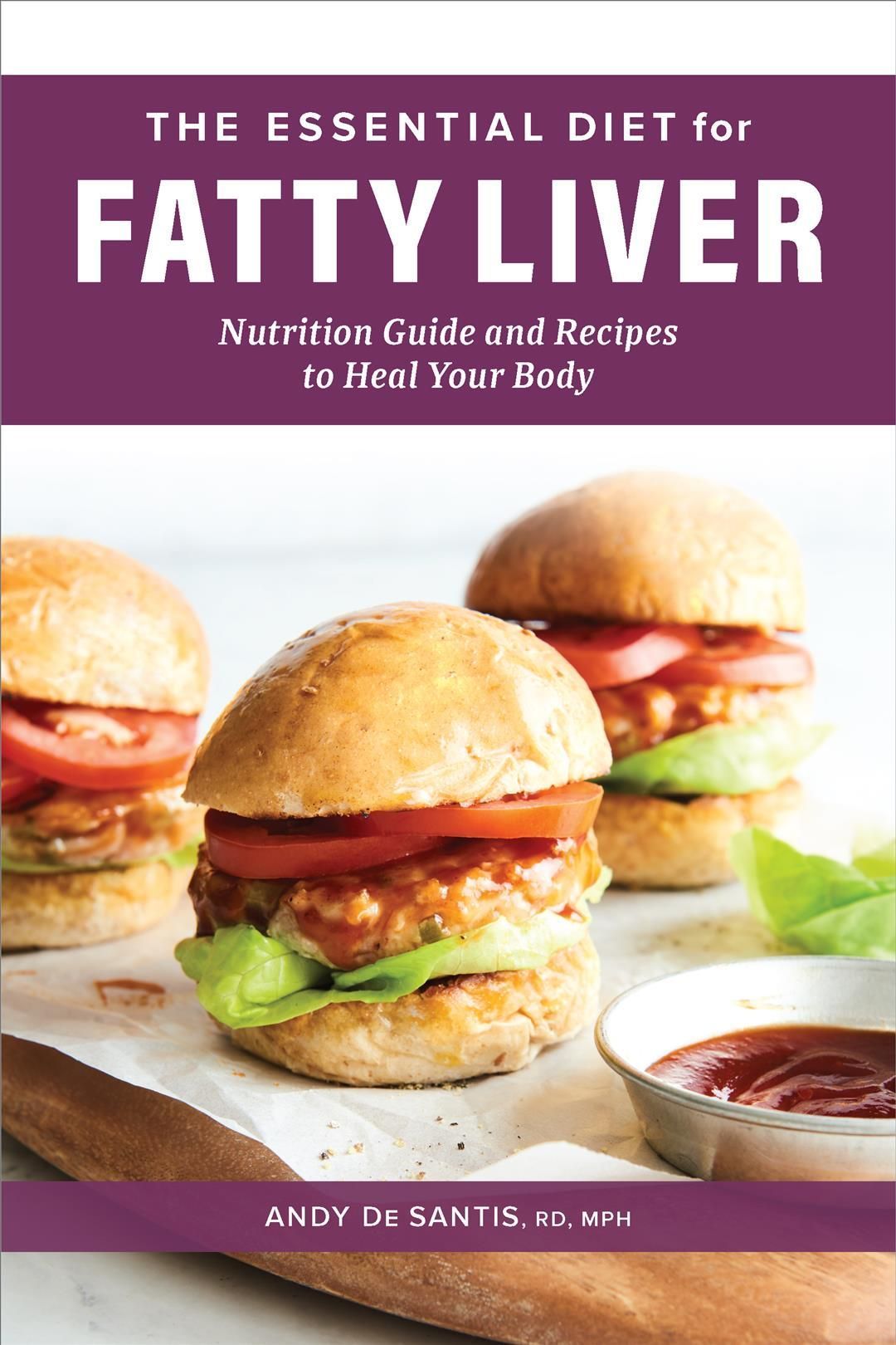 The Essential Diet for Fatty Liver By Andy De Santis 9781638780441