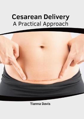 Cesarean Delivery: A Practical Approach By Davis 9781639271504