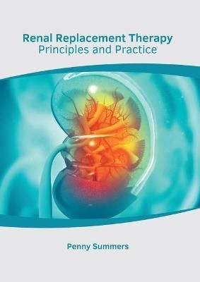 Renal Replacement Therapy: Principles and Practice By Summers