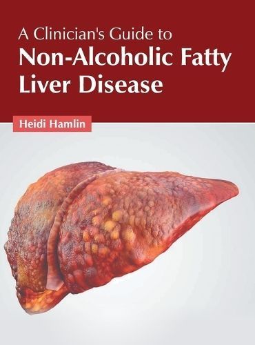 Clinician's Guide to Non-Alcoholic Fatty Liver Disease By Hamlin